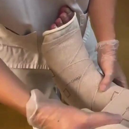 Tiento Compression Terapia de compresión